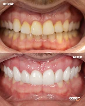 Slider image (5) Care Smile Center